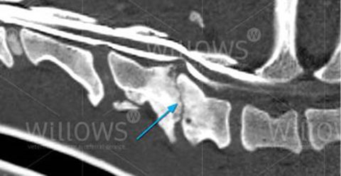 Cervical figure 5