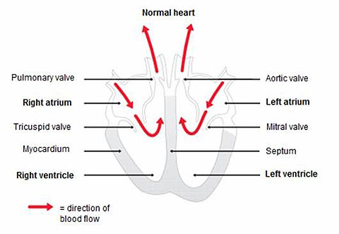 Dilated Cardiomyopathy figure 1