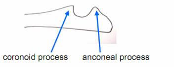 Elbow Dysplasia figure 2