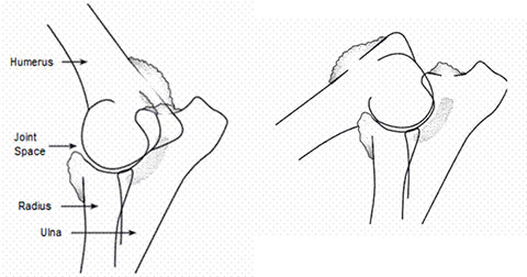 Elbow Dysplasia figure 4