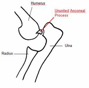 Elbow figure 3