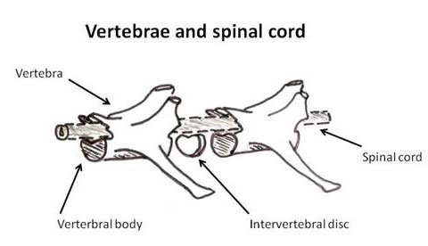 Intervertebral Disc Disease figure 2