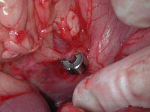 Portosystemic Shunt figure 2